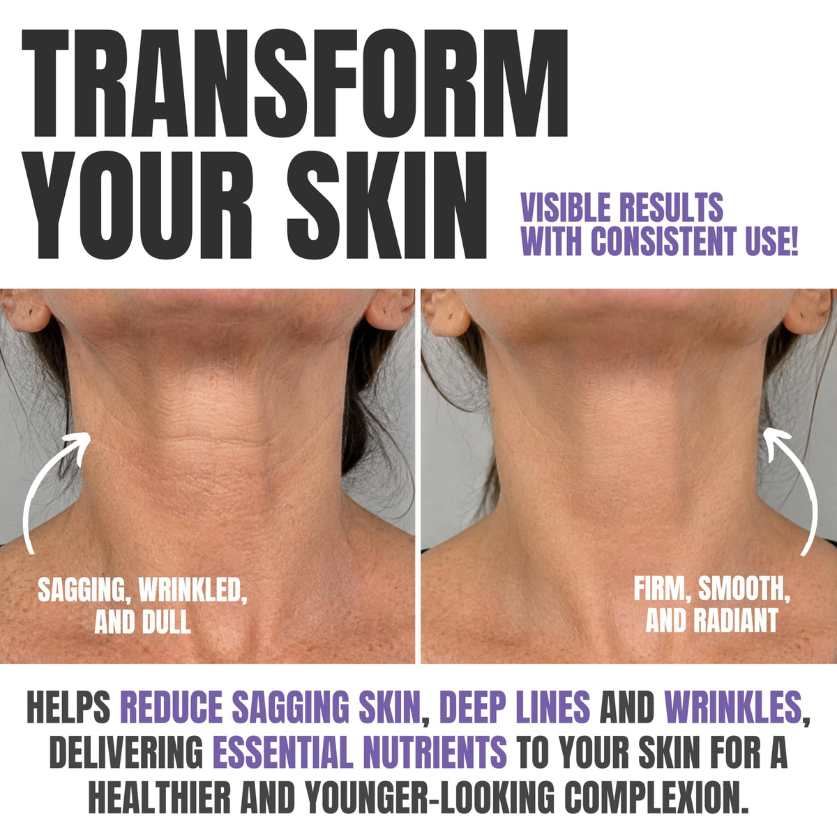 Alozera Neck Cream for Tightening and Firming 50ml