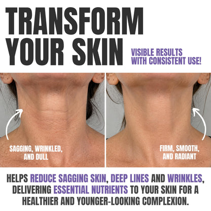 Alozera Neck Cream for Tightening and Firming 50ml